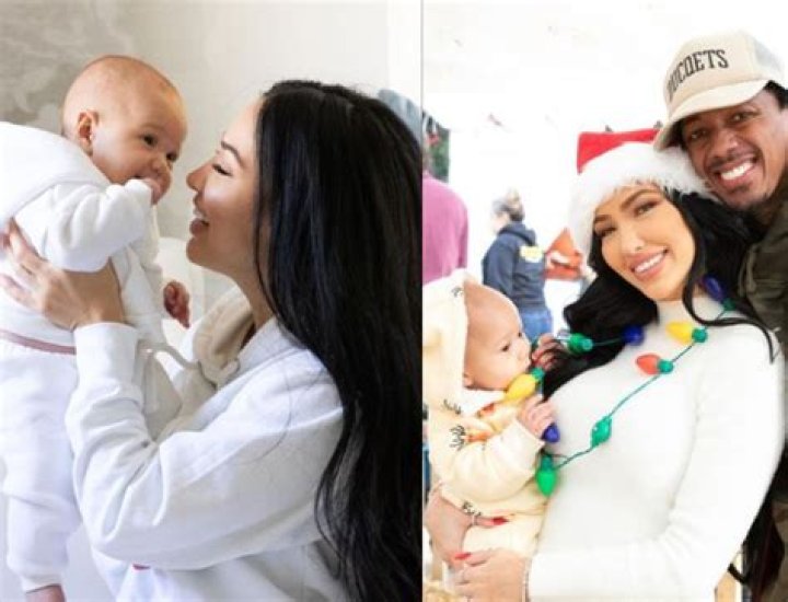 Nick Cannon's son's mother Brittany ditches clothes in new pic, revealing childhood skin condition