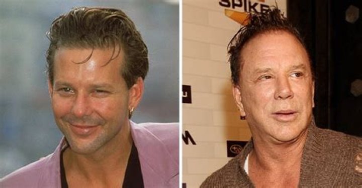 Mickey Rourke Looks Unrecognizable after Plastic Surgery – A Glimpse inside His Changing Faces