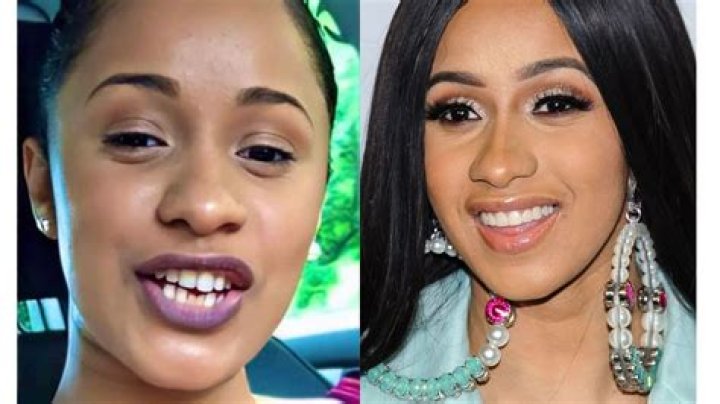 Cardi B's Teeth Before and After: Cost, Dentist, and Other Facts
