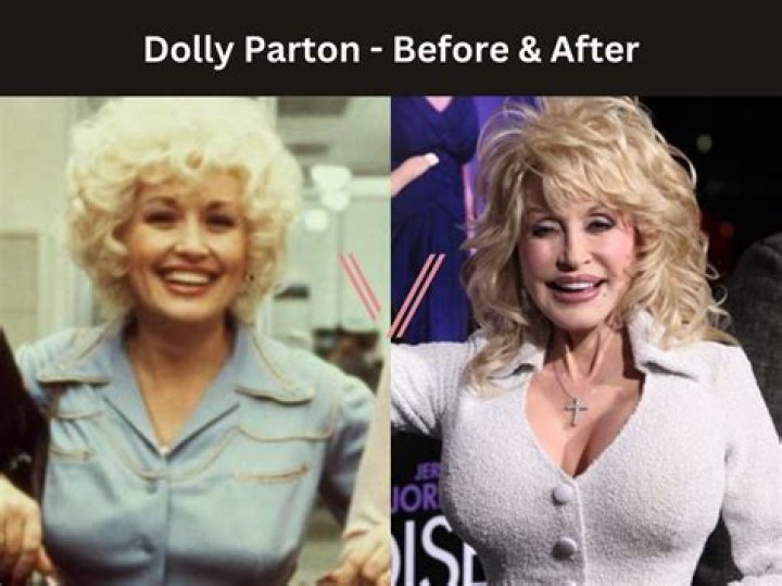 Dolly Parton — Look inside 8 Features and Actions That Totally Describe Her Personality