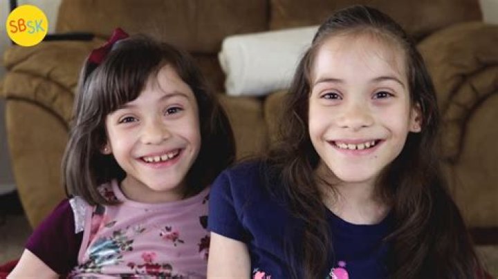 Twins Who Were Bullied in School Look Unrecognizable after Spending $200,000 on Surgery