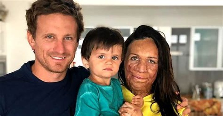 Man Refuses to Leave His Beloved despite Her Damaged Looks & Marries Her - They Welcome 2 Cute Kids