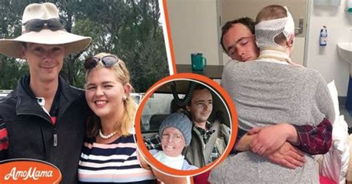 Woman Whose Face Burned off in a Campfire Gives Her Husband Permission to Leave Her, He Refuses