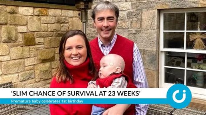 Doctors Give Slim Chance of Survival for Conjoined Twins — They Celebrate 5th Birthday