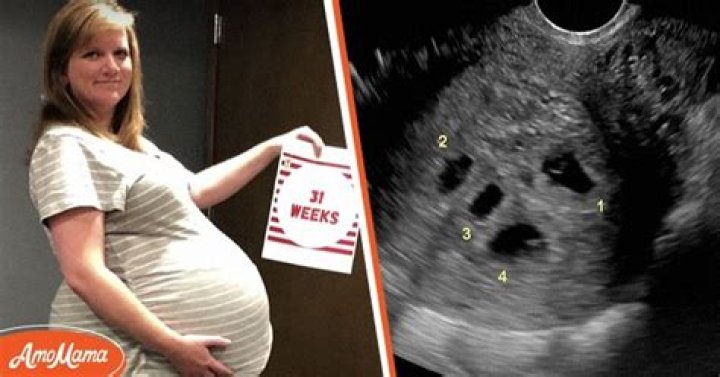 Pregnant Mom Goes in for Ultrasound, Technician Says She Hears Five Heartbeats Instead of One