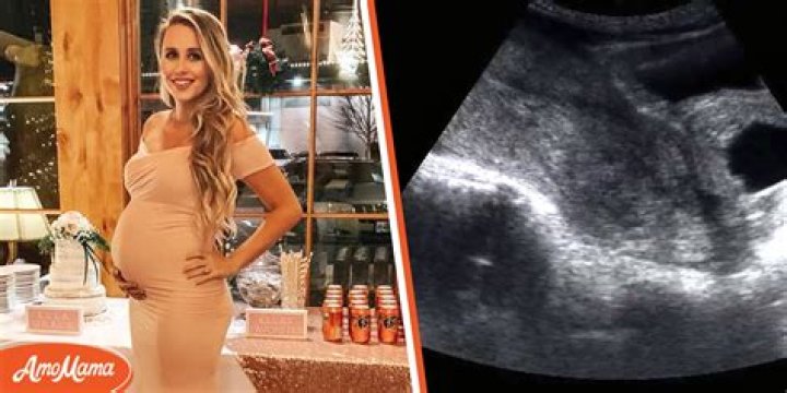 Pregnant Mom Goes for an Ultrasound, Doctor Shows Her There Is No Baby There