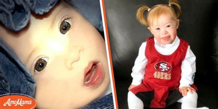 Mom Is Told to Give Up Daughter with Down Syndrome — She Becomes a Famous Star Years Later
