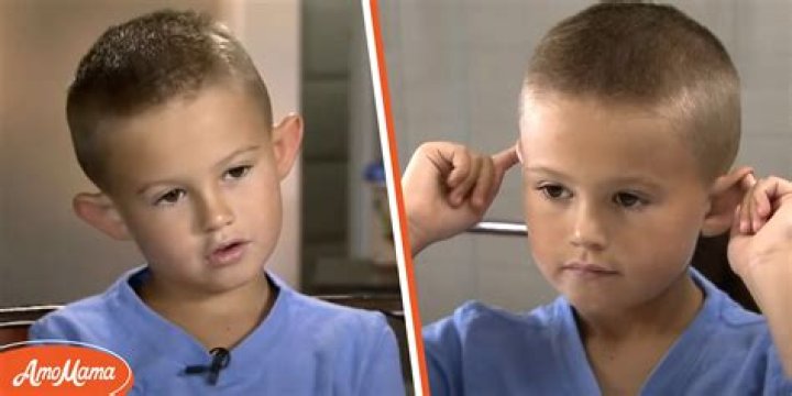 Boy Is Bullied for 'Elf Ears,' Finally Smiles after Seeing Them Fixed in Just 2 Hours