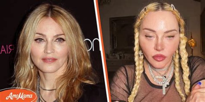 What Did Madonna Do to Her Face? The 63-Year-Old Singer Looks Youthful