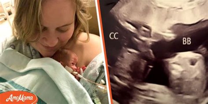 Mother Is Told Her Triplets Will Likely Not Survive, Delivers the Children in Different Years