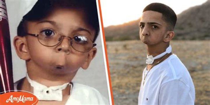 Boy without Jaw Who Has Never Spoken a Word Becomes a Famous Rapper