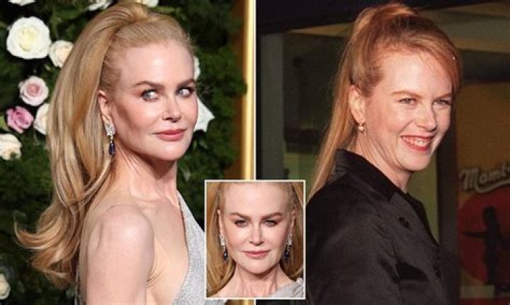 Has Nicole Kidman Had Plastic Surgery? The Actress's Face Has Been under Scrutiny for Years