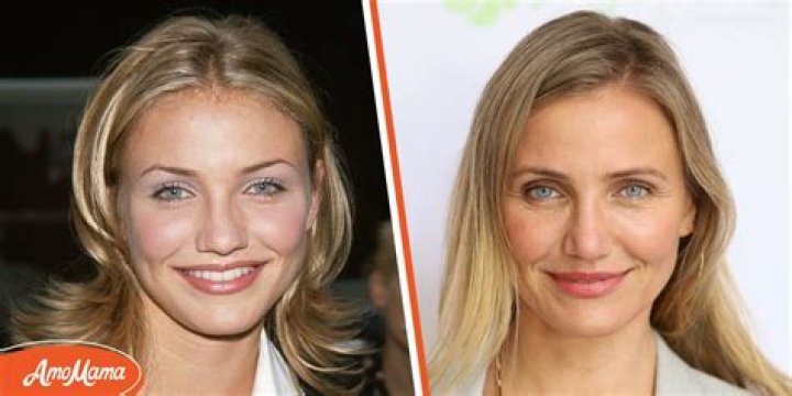 Cameron Diaz’s Plastic Surgery Changed Her Face ‘in a Weird Way’