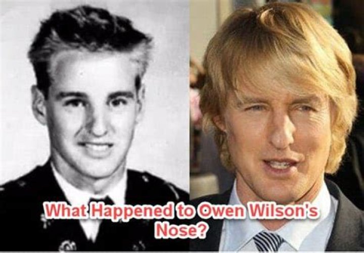 What Happened to Owen Wilson's Nose? He Once Told the Story behind It