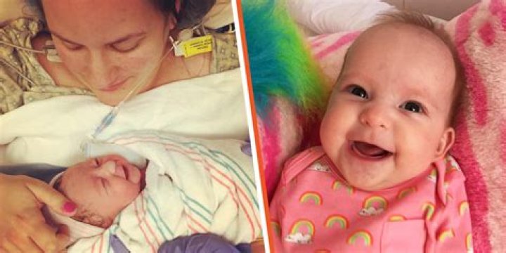 Baby Born without Nose Looks 'Amazing' at 10 after Surgery - Her Mom Always Considered Her 'Perfect'