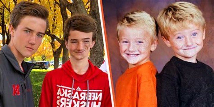 Boy Taunted by Walmart Cashier for His Face That Abruptly Began to Cave at 6 - His Twin Comforts Him