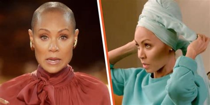 Jada Pinkett Smith Shows Her Hair Finally Growing Back in Latest Post: Why Fans Think She’s Lying She’s Sick
