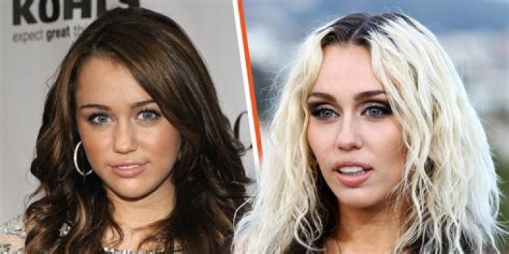 Miley Cyrus’ Plastic Surgery Rumors Reignited as Her Face Looked ‘Enhanced’ in a 2022 Pic