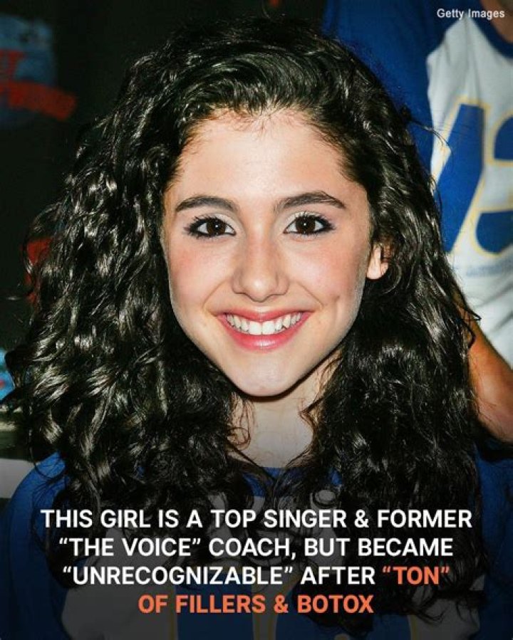 This Girl, Who Is a Top Singer, Survived a Bombing — She Was Once 'Unrecognizable' but Still Has ‘Cute’ Dimples