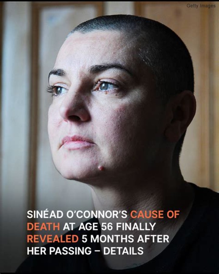 Sinéad O'Connor's Cause of Death at 56 Is Finally Revealed — Details