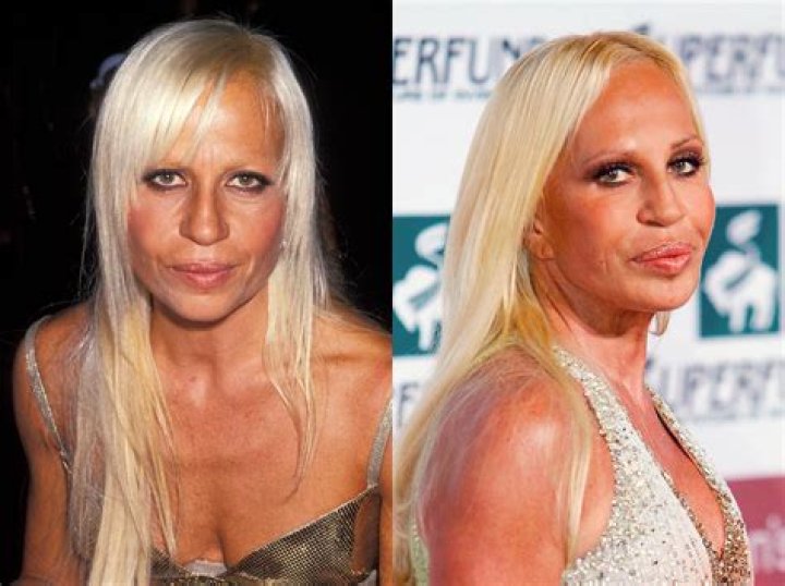 How Donatella Versace Would Look At 68 If She Never Used Botox: 5 Photos via AI