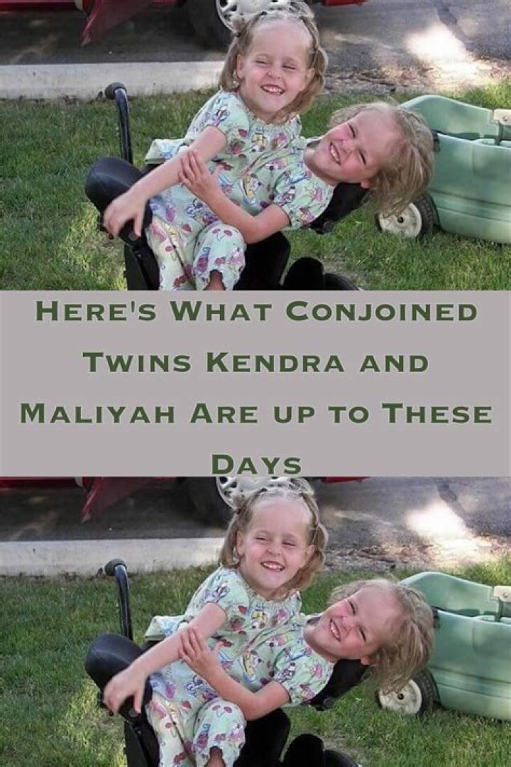 Remember conjoined twins Kendra and Maliyah? They are no longer little kids and look great
