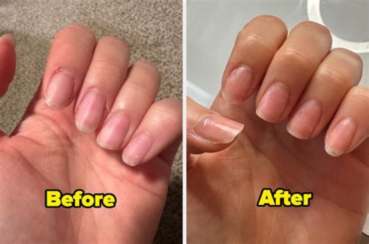 Woman was denied a manicure due to her scars